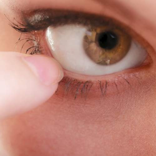 What You Need to Know About Chronic Dry Eye