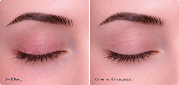 Ndemex™ Revitalizing Eye Serum with Tea Tree Oil