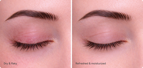 Ndemex™ Revitalizing Eye Serum with Tea Tree Oil – Bruder Healthcare
